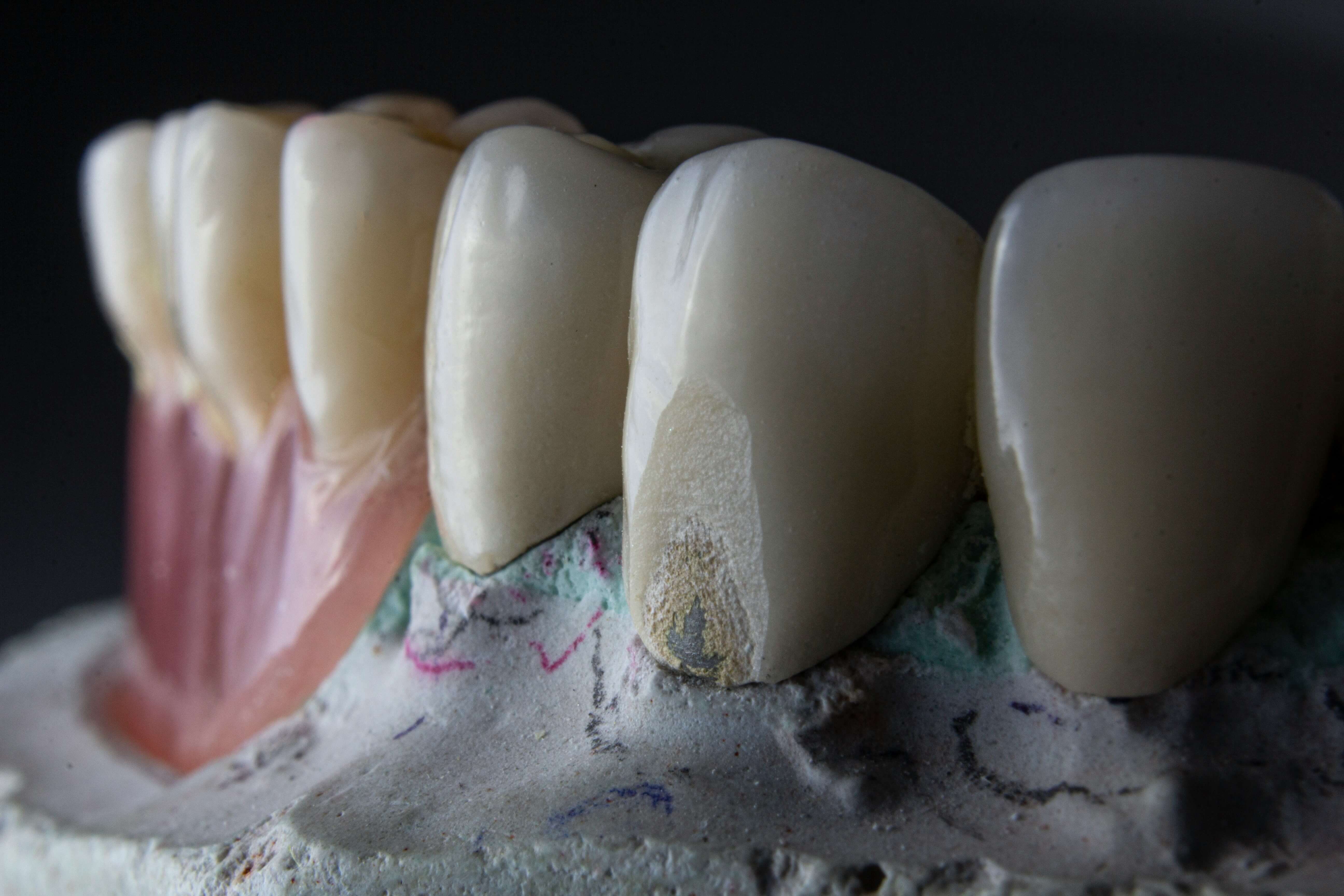 Endodoncia